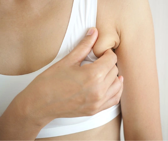 Axillary Breast Excision<br />
