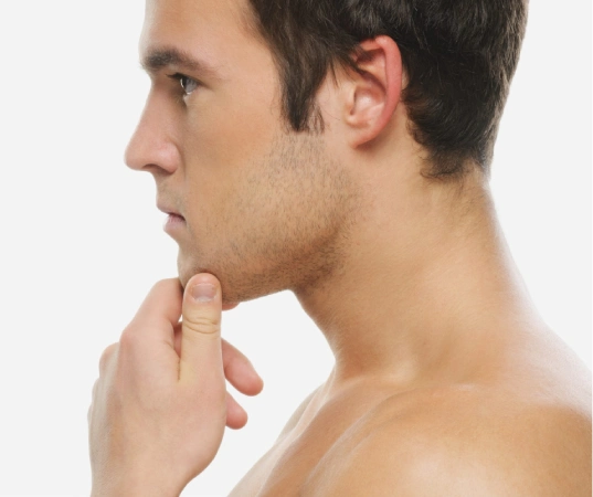 Face And Neck Lift