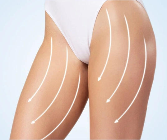 Thigh Lift