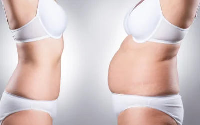 Spot Reduction” Made Simple: Why Some Areas Don’t Budge—And What Actually Helps