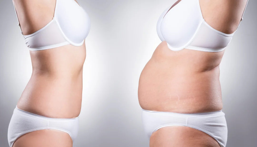 Spot Reduction” Made Simple_ Why Some Areas Don’t Budge